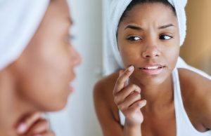 5 Good Techniques On Getting Rid of Pimples On The Forehead Getting Rid of Pimples On The Forehead